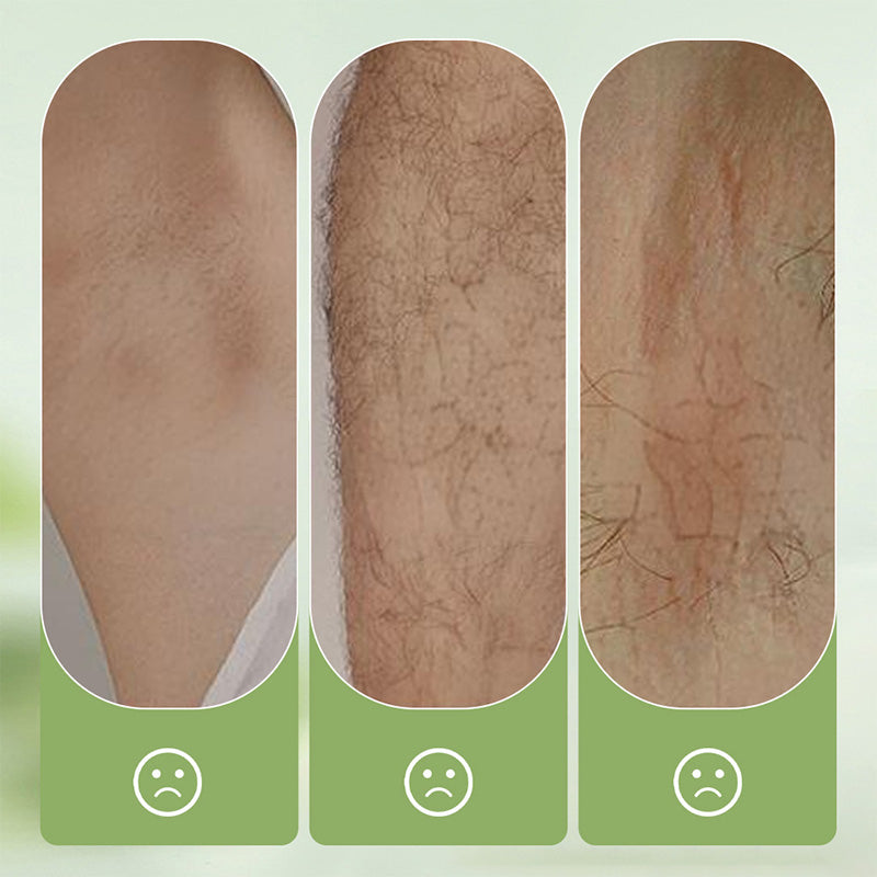 SmoothGuard Hair Removal Cream