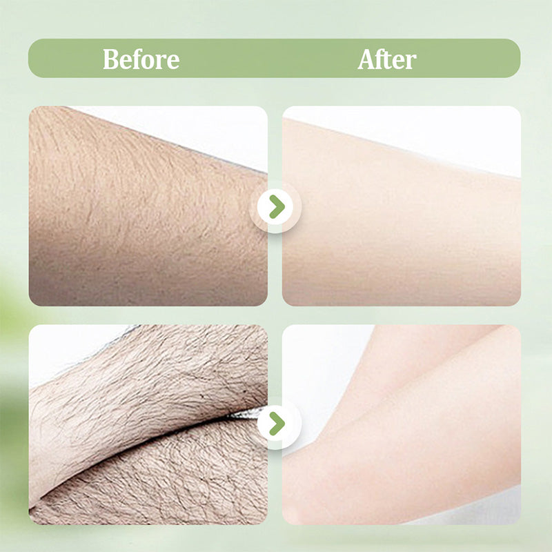 SmoothGuard Hair Removal Cream